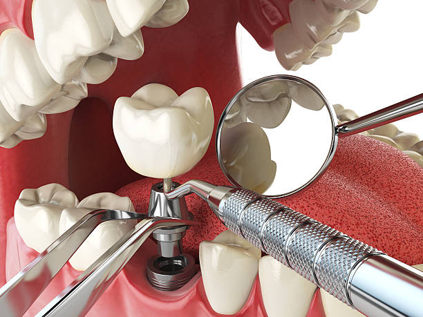 Best Urgent Care for Lost Fillings or Crowns in Dayton, KY